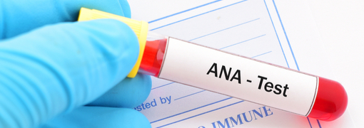 בדיקת Anti-Nuclear Ab's - תמונה